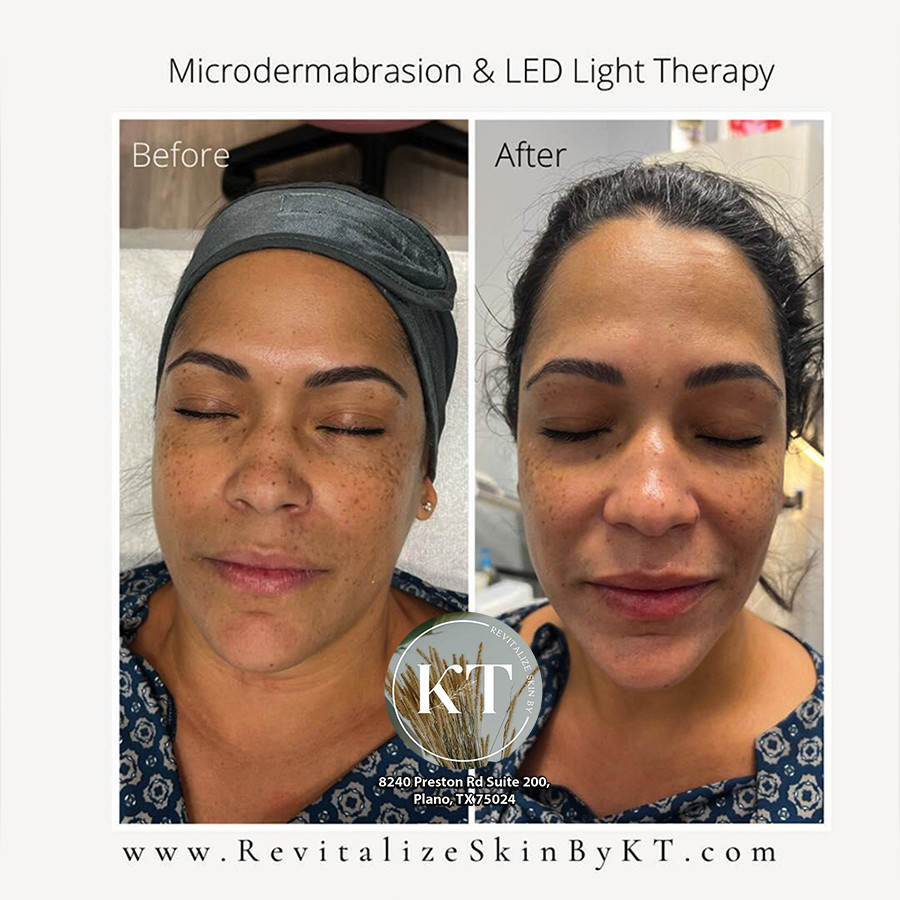 REVITALIZE SKIN BY KT - Best day spa Plano, TX 75024